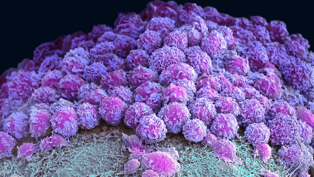 Il mini colon e gli “organoidi” cerebrali fanno luce sul cancro e su altre malattie
